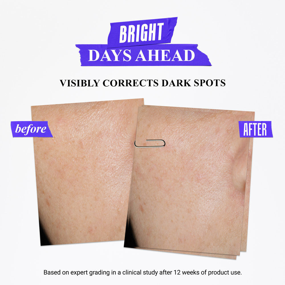 Kiehl's Clearly Corrective Dark Spot Solution With Activated C & Buffered Salicylic Acid, 30ml