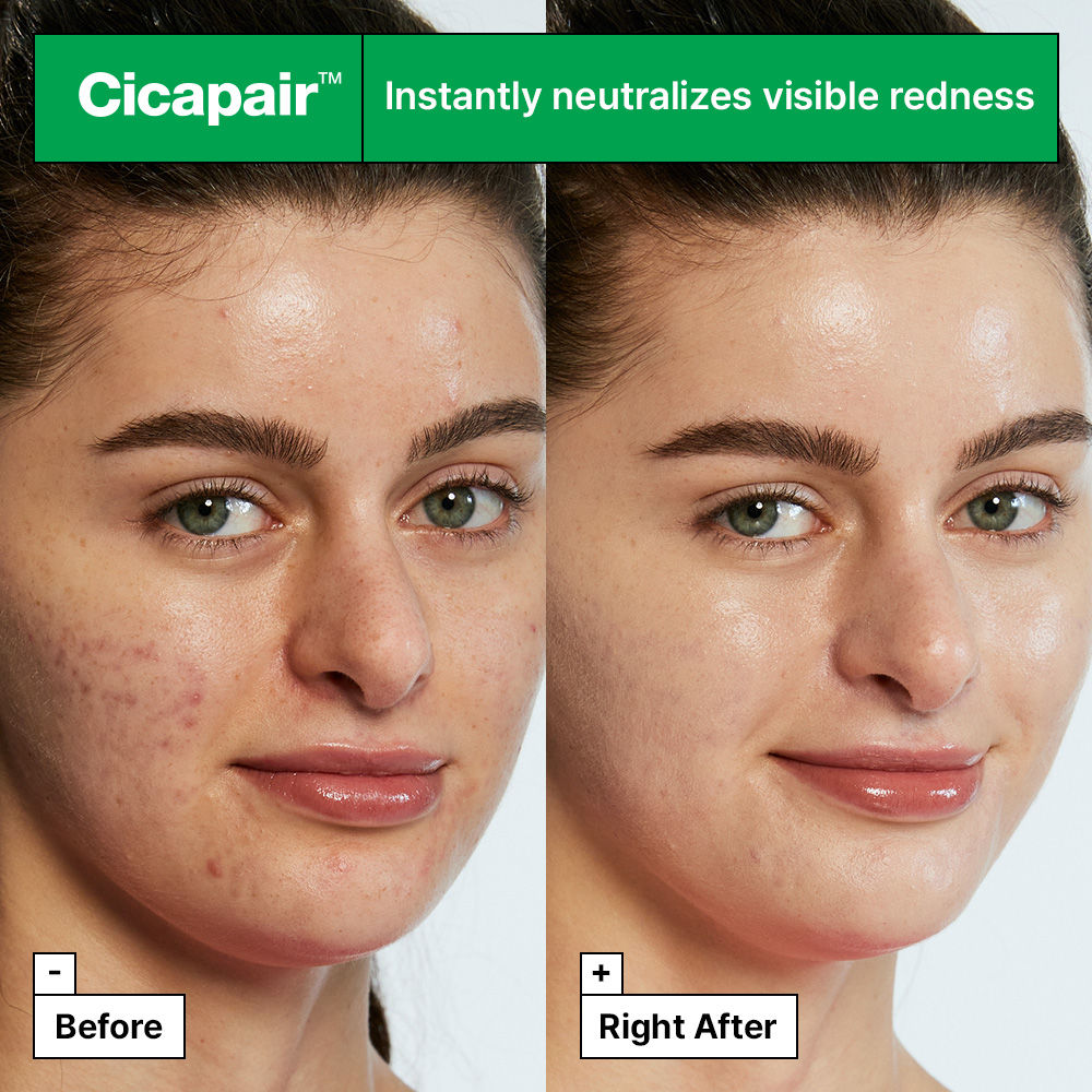 Dr.Jart+ Cicapair Tiger Grass Color Correcting Treatment With Cica Extracts & Niacinamide, Dermatologist Tested, 15ml