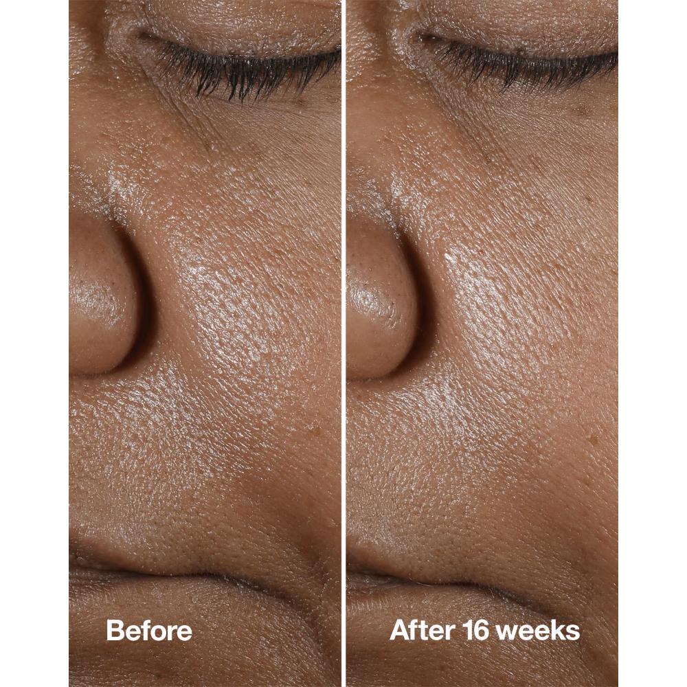 Clinique Smart Clinical Repair Wrinkle Correcting Serum With Retinoid, 30ml
