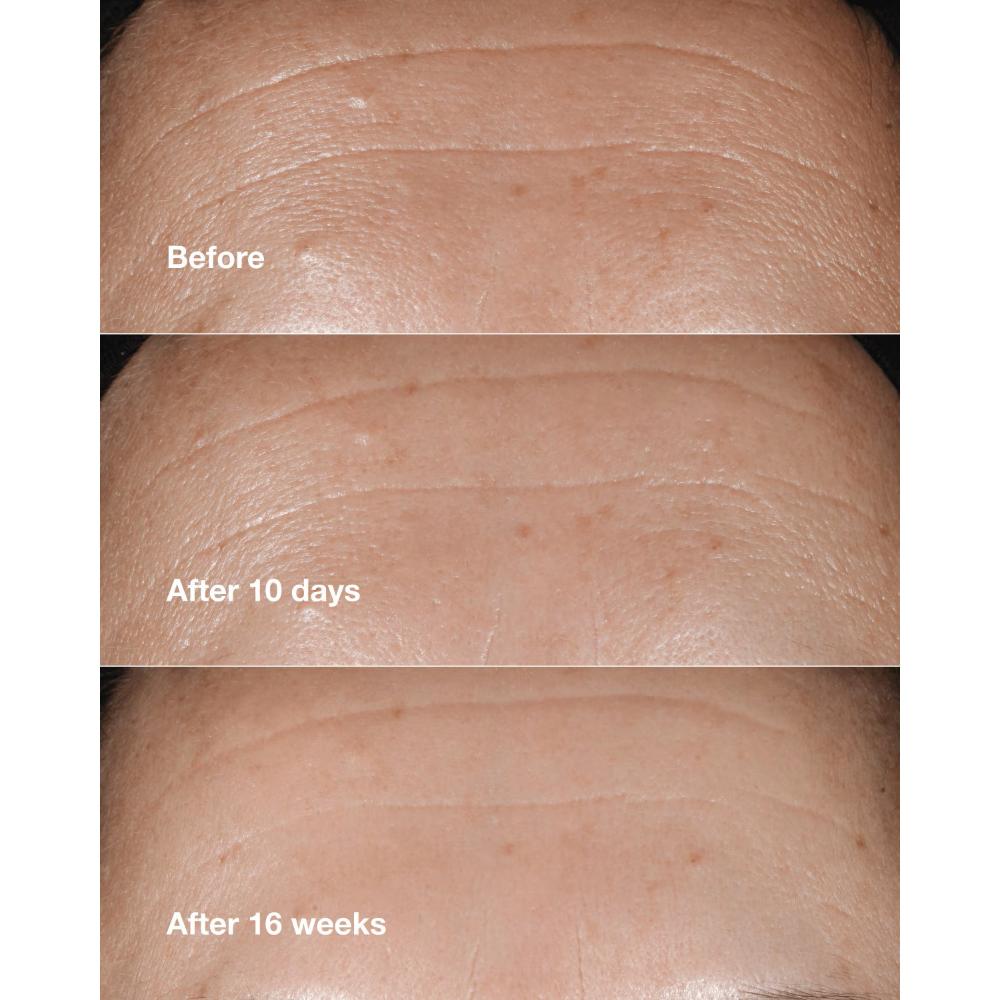 Clinique Smart Clinical Repair Wrinkle Correcting Serum With Retinoid, 30ml