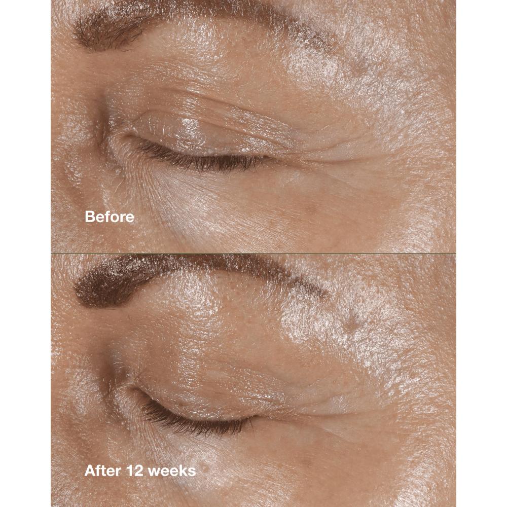 Clinique Smart Clinical Repair Wrinkle Correcting Eye Cream With Peptides, 15ml