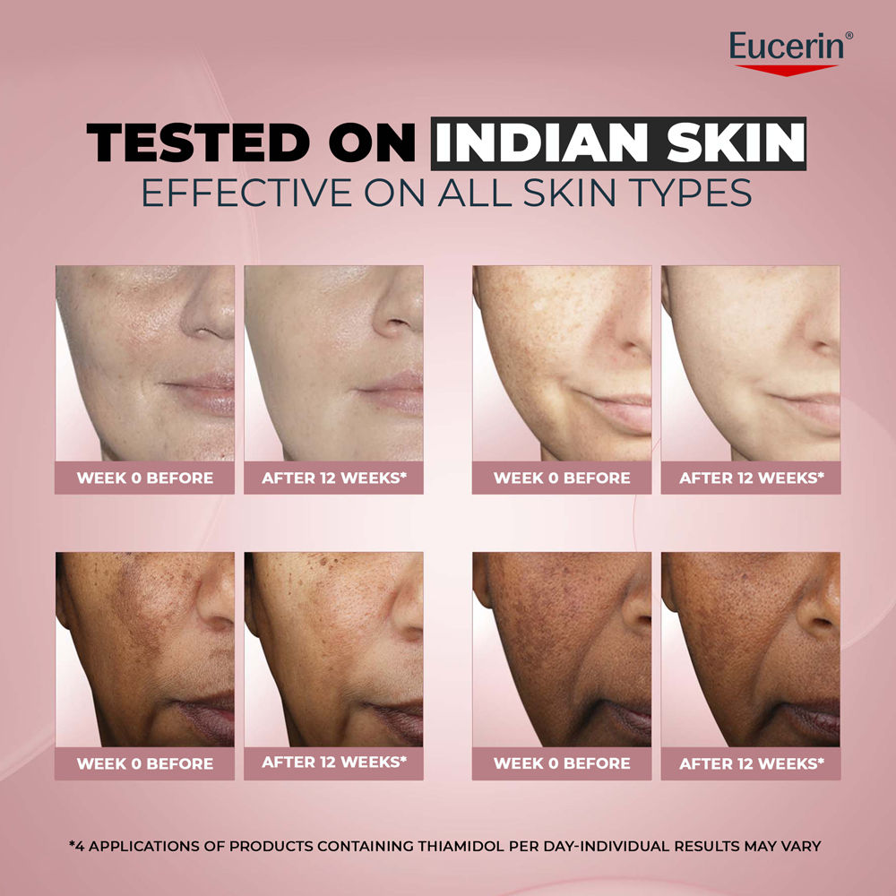 Eucerin Anti-Pigment Dual Serum With Thiamidol & Hyaluronic Acid, Reduces Dark Spots & Rejuvenates, 30ml