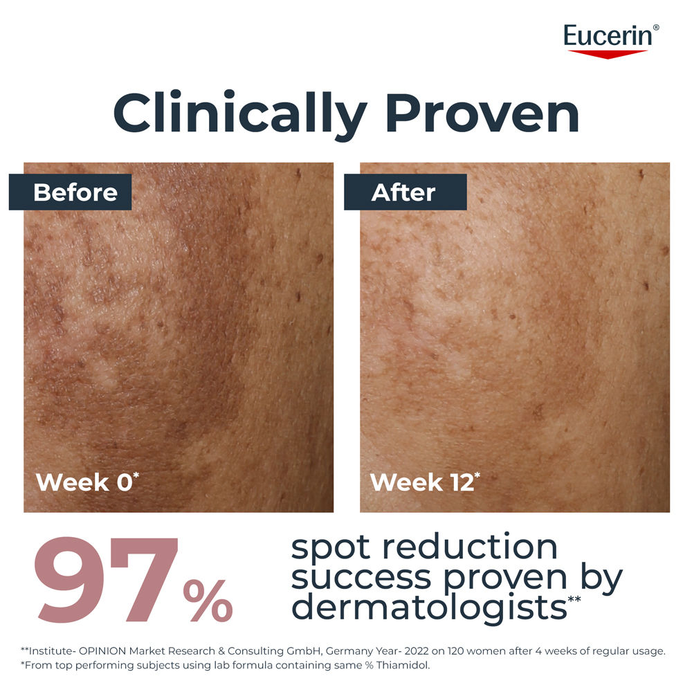 Eucerin Anti-Pigment Dual Serum With Thiamidol & Hyaluronic Acid, Reduces Dark Spots & Rejuvenates, 30ml