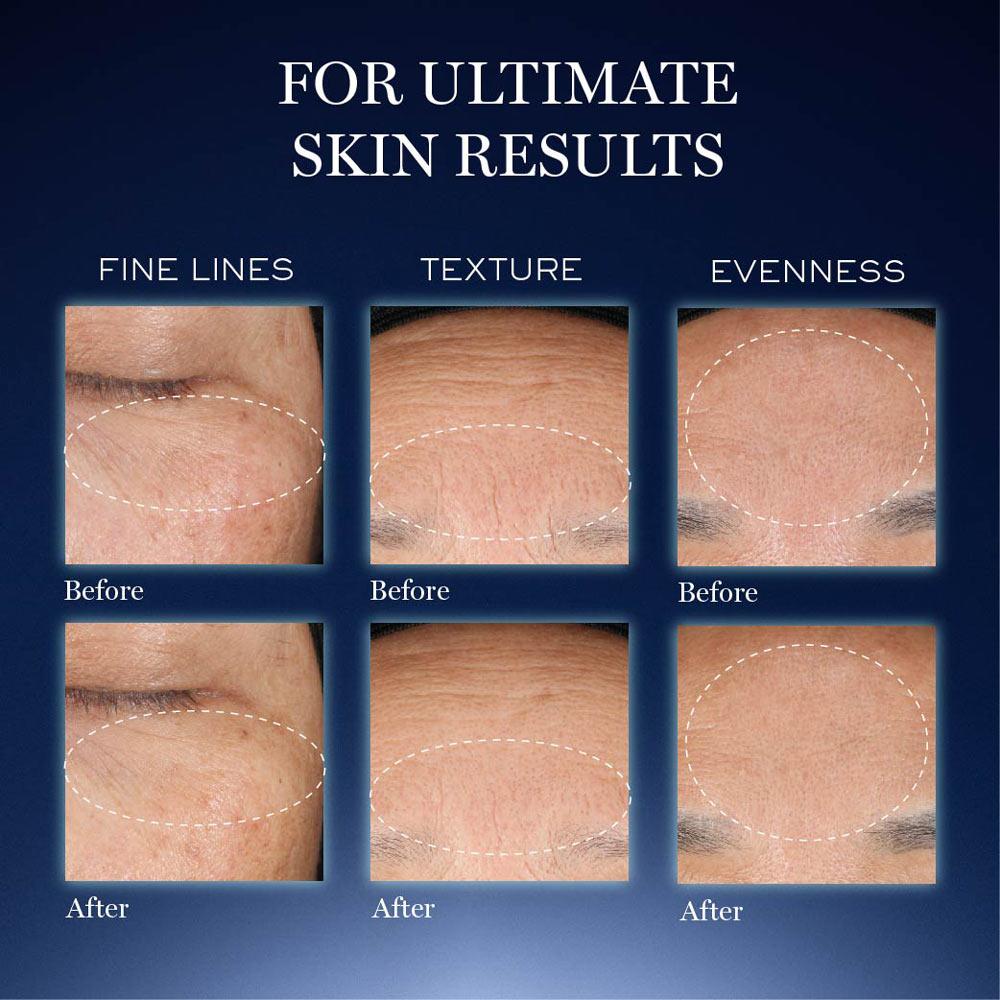 Lancome Genifique Ultimate Skin Repair Serum With Beta Glucan Suited for Indian Skin, 50ml