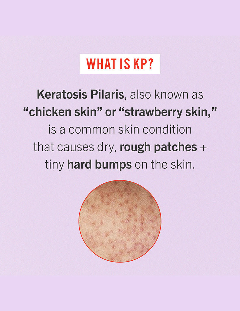 First Aid Beauty KP Bump Eraser Body Scrub With 10% AHA, 57g
