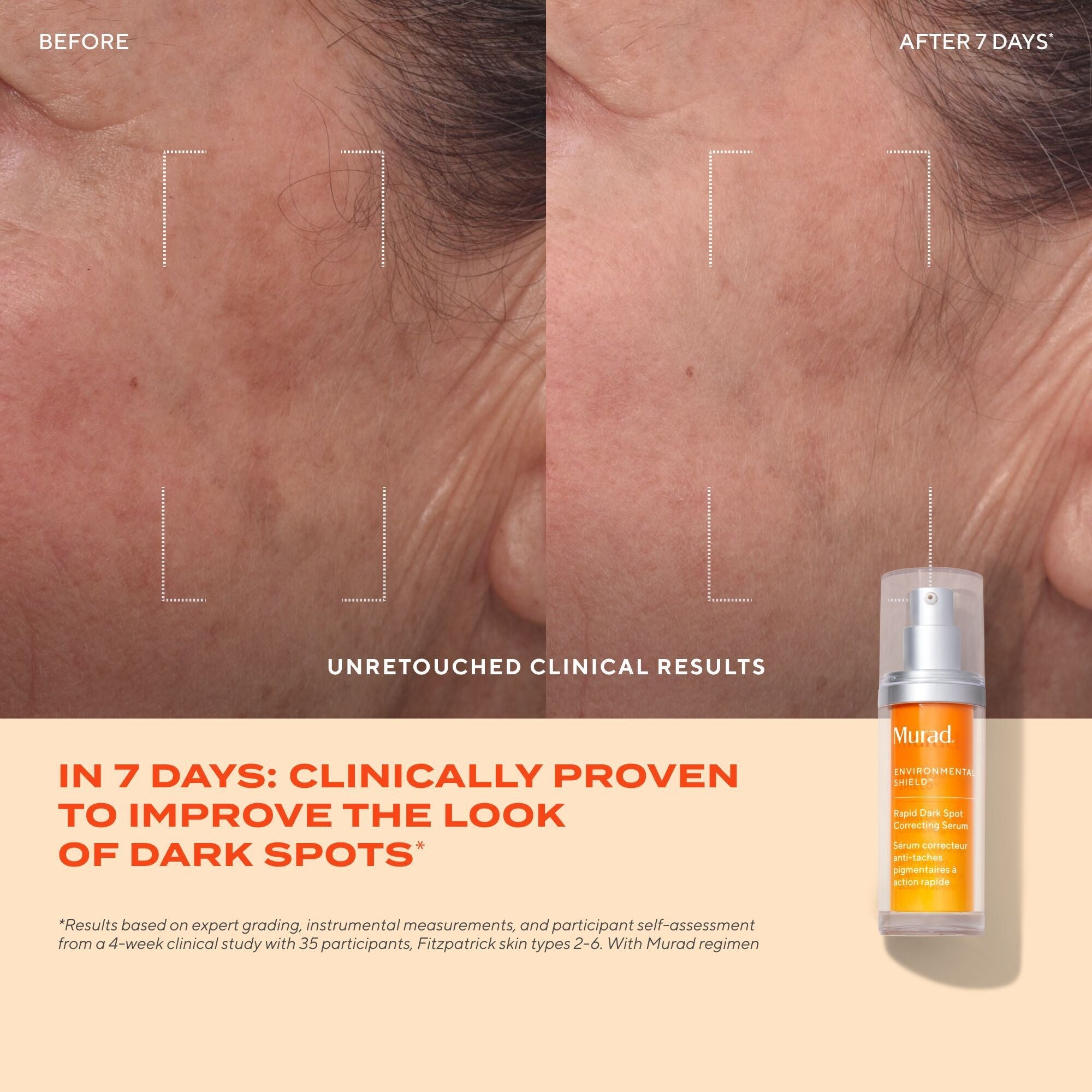 Murad Rapid Dark Spot Correcting Serum, 30ml