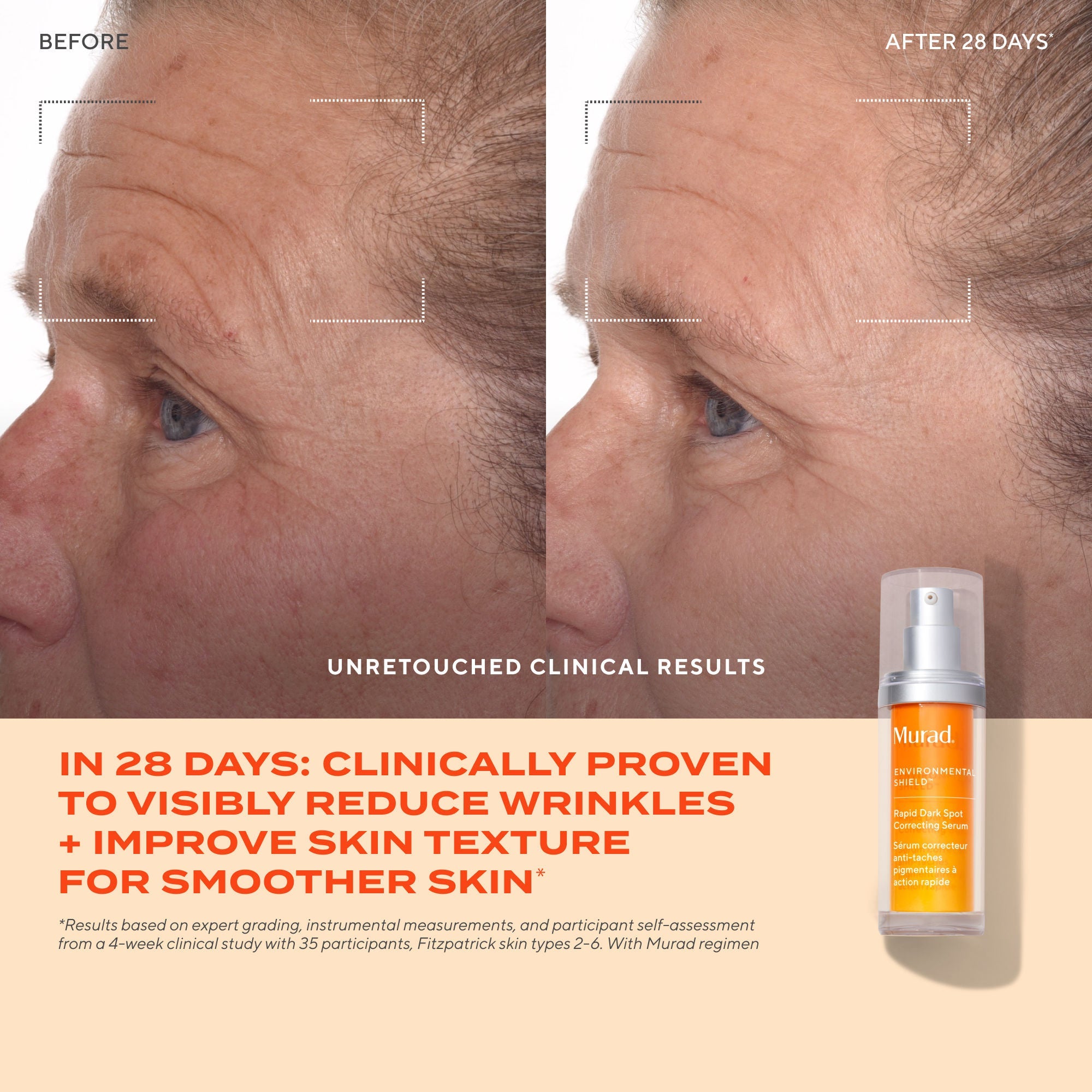 Murad Rapid Dark Spot Correcting Serum, 30ml