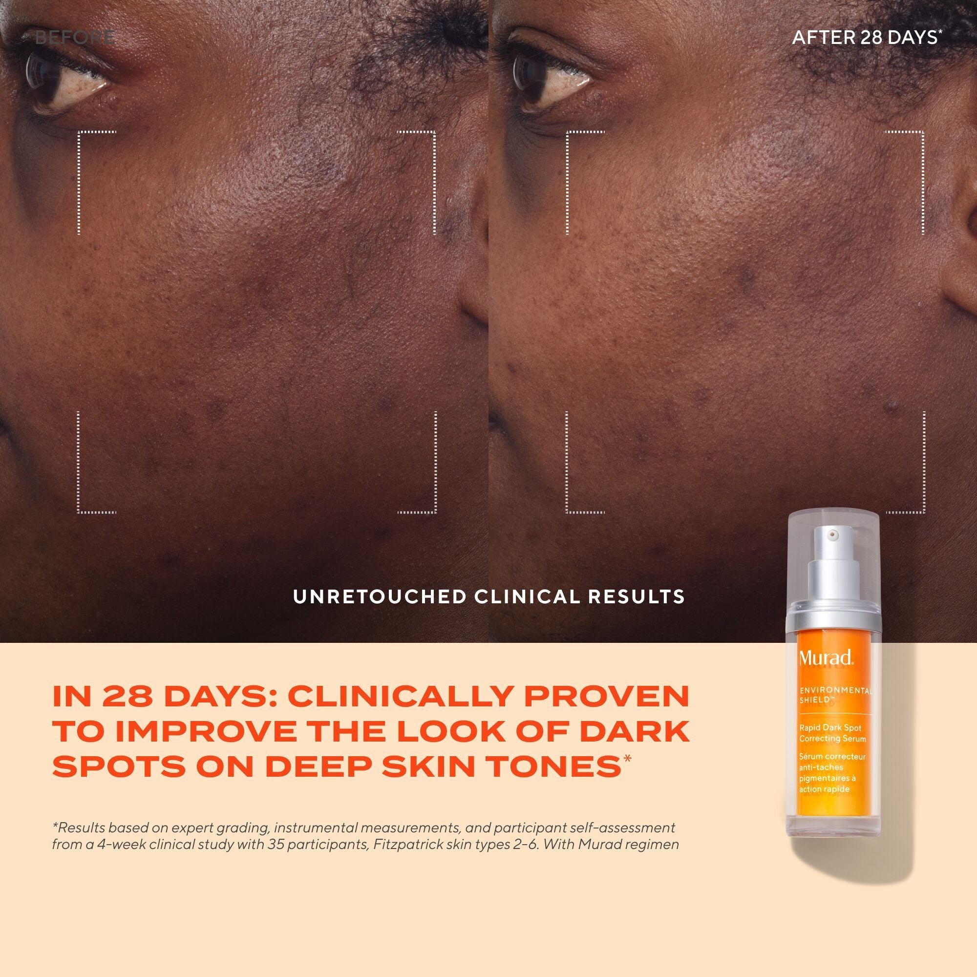 Murad Rapid Dark Spot Correcting Serum, 30ml