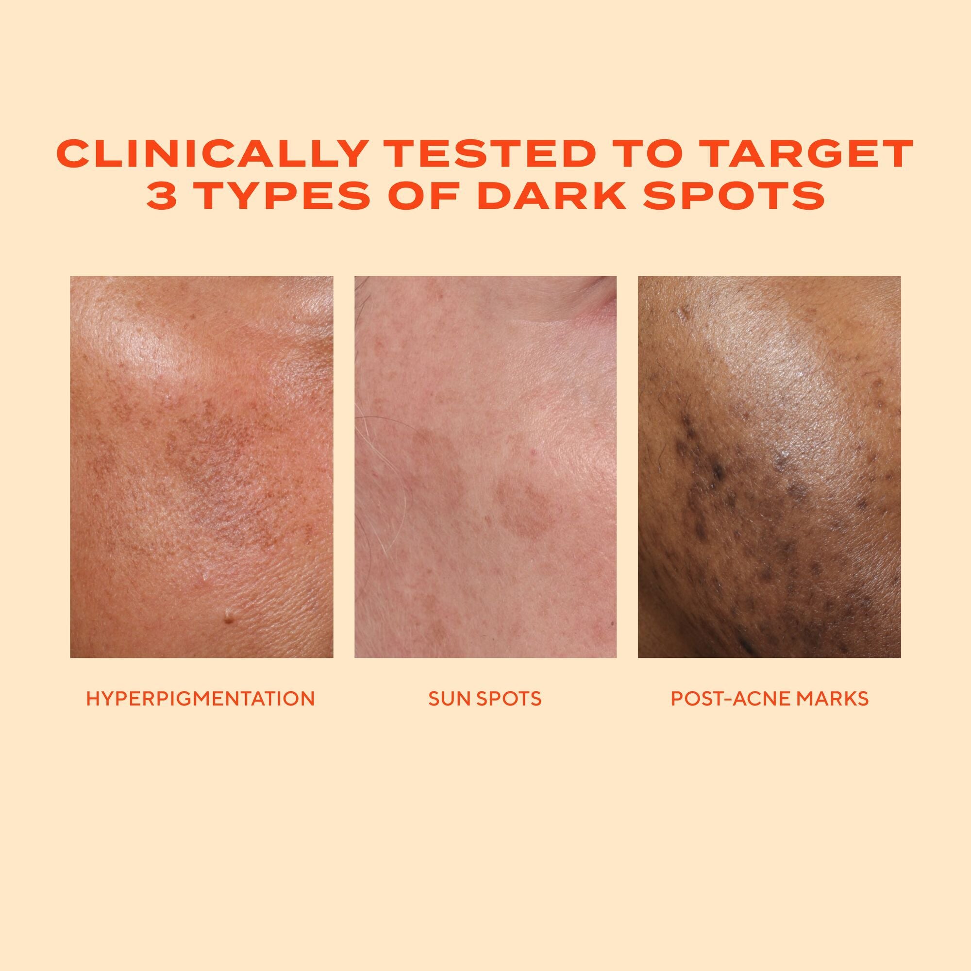 Murad Rapid Dark Spot Correcting Serum, 10ml