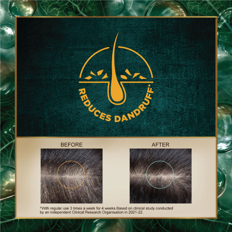 Indulekha Dandruff Treatment Shampoo, 340ml Buy at Indicrest Image 3