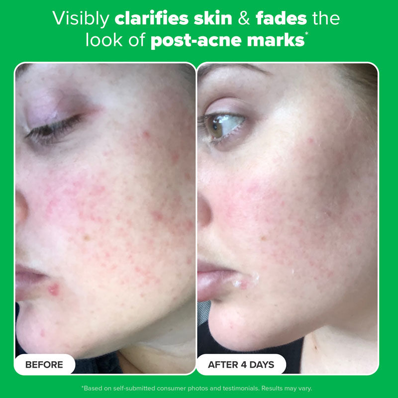 Paula's Choice Boost 10% Azelaic Acid Booster, 30ml