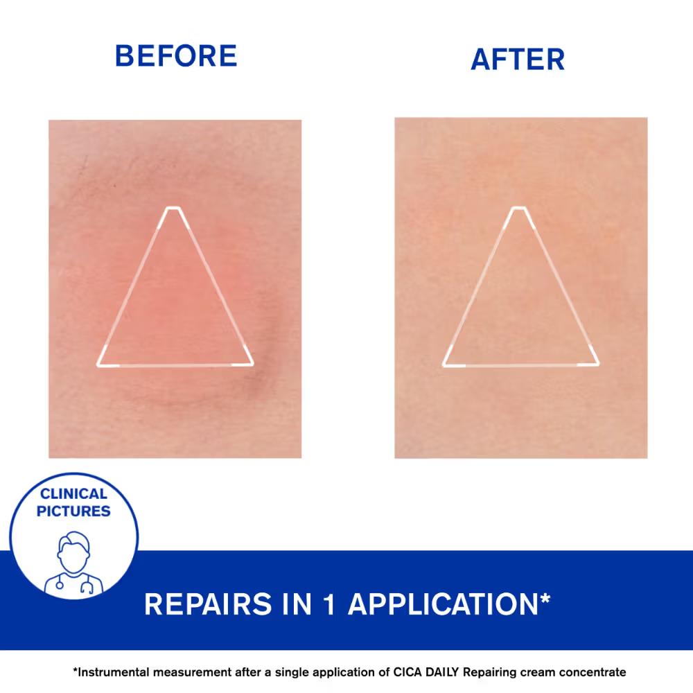 Uriage Cica-Daily Intense Repairing Anti-Pollution Serum 10.5% Thermal Biotic Complex Repairs Skin, 30ml