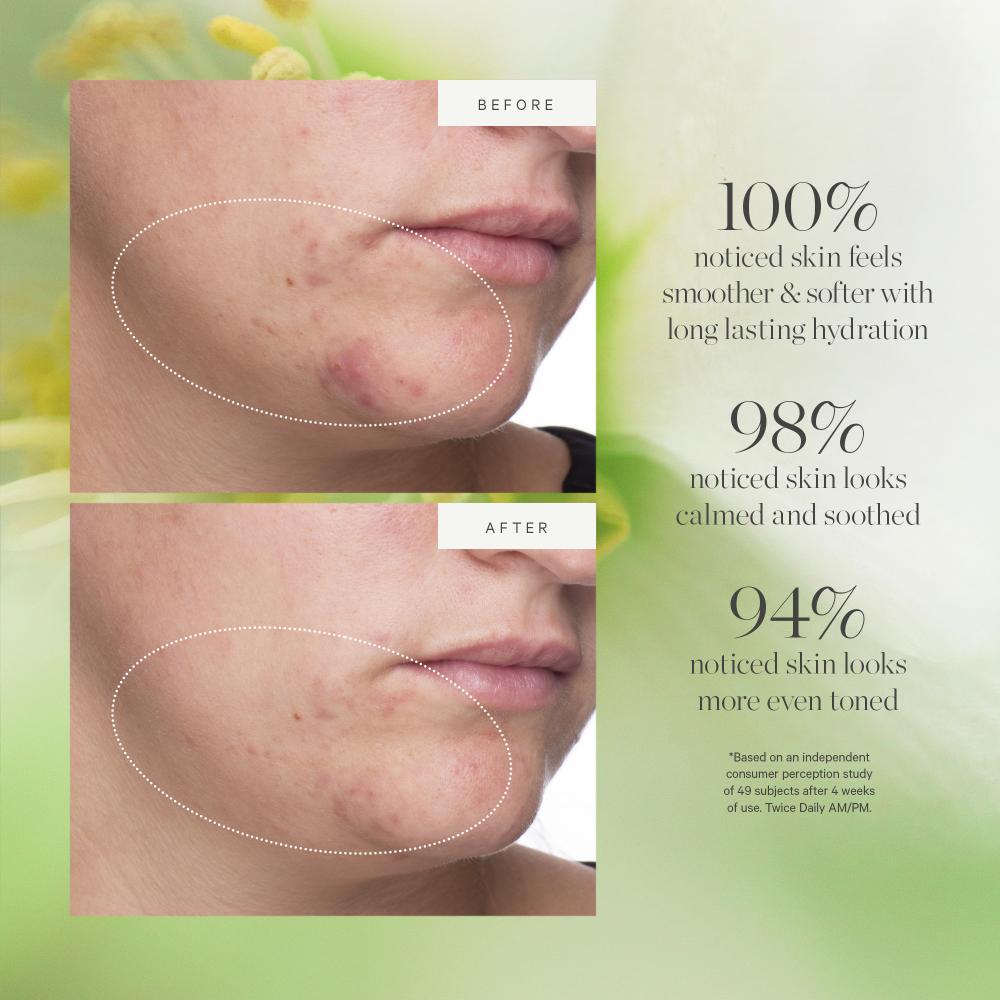 Kora Organics Active Algae Moisturizer- Reduces Dullness Fine Lines Pores With Green Algae Green Tea, 15