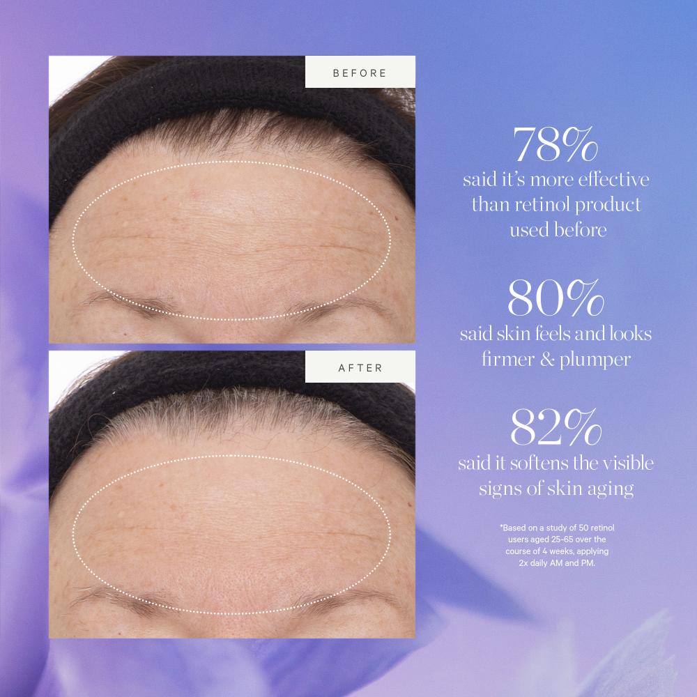 Kora Organics Plant Stem Cell Retinol Altertive Serum Firms Smooths Protect With Bakuchiol Rosehip, 10