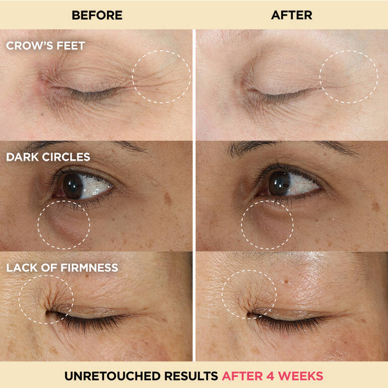 IT COSMETICS Confidence In An Eye Cream, 15ml