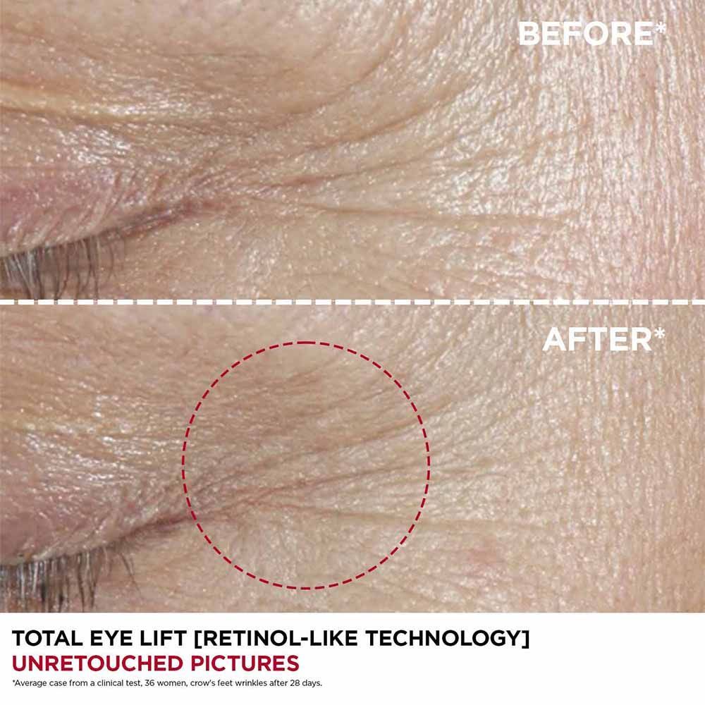 Clarins Total Eye Lift 15 ml, 15ml