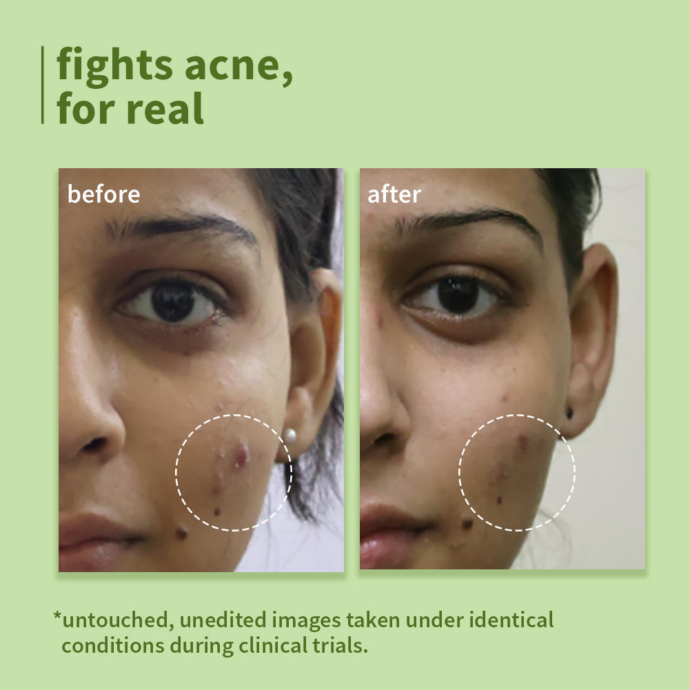 Plum Green Tea Pore Cleansing Face Wash for Acne | Controls Oil Upto 2-Hrs | Reduces Acne In 7 Days, 150ml Buy at Indicrest Image 2