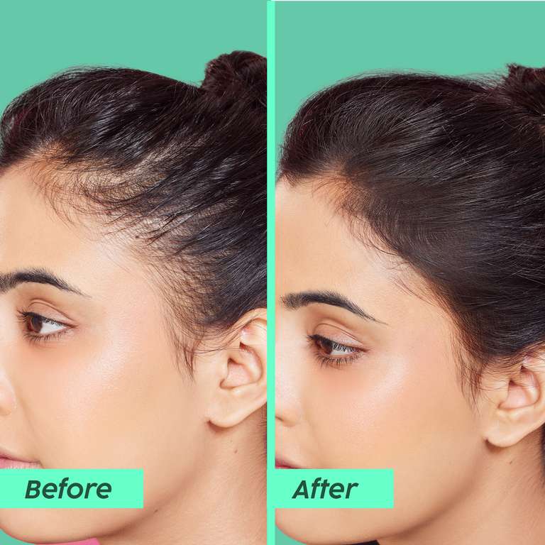 Plix Rosemary Anti-Hair Fall Advanced Conditioner for Soft, Smooth & Shiny Hair, 175ml Buy at Indicrest Image 2