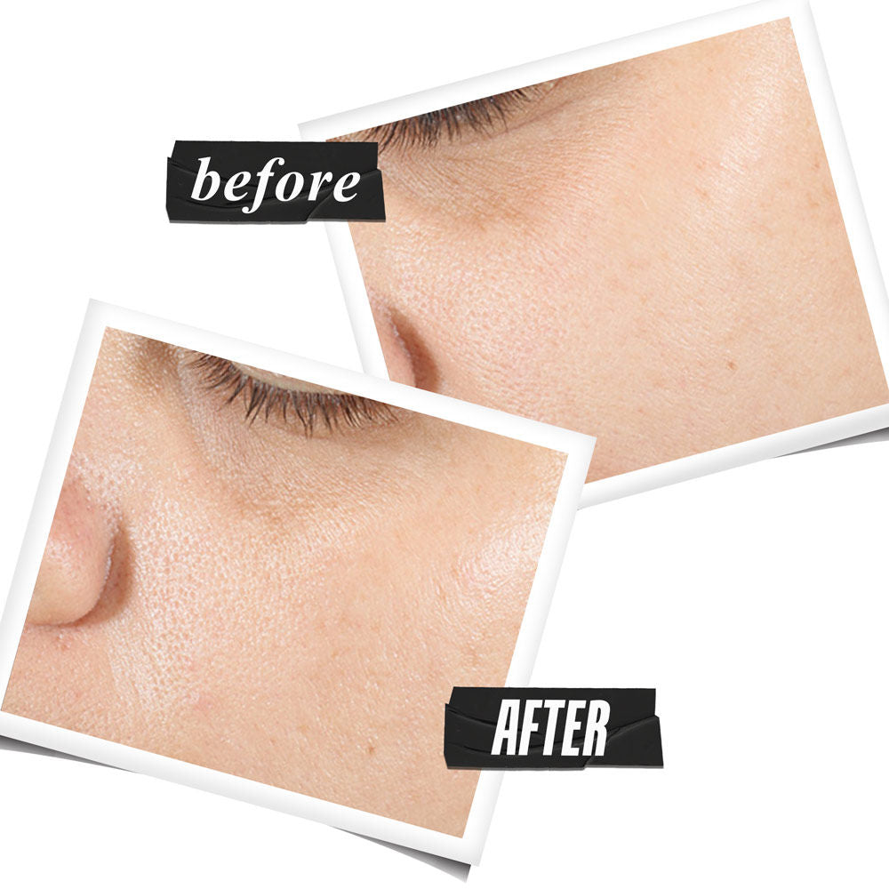 Kiehl's Ultra Pure High-Potency Serum - With 1.5 Hyaluronic Acid, 30ml