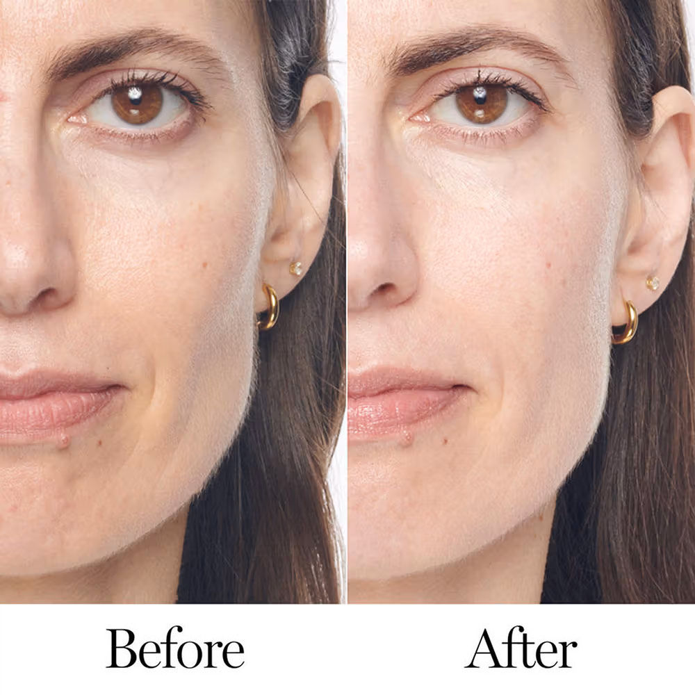 Lancome Renergie H.C.F. Triple Serum - Advanced Anti-Aging Hyaluronic Acid & Vitamin C, 50ml