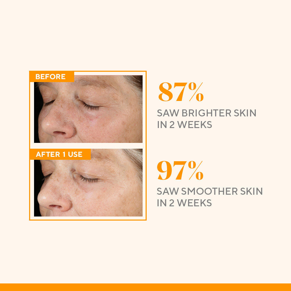 Murad Environmental Shield Vitamin C Triple Exfoliating Facial, 80ml
