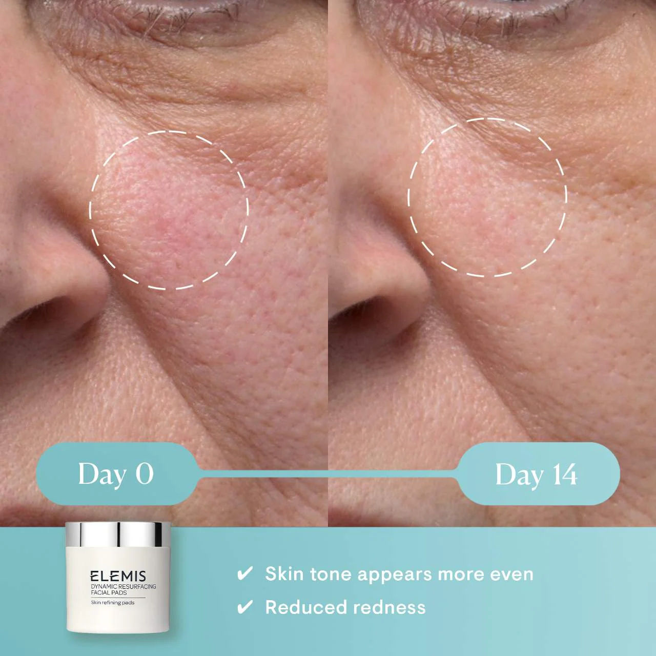 Elemis Dymic Resurfacing Facial Pads, 60 pcs