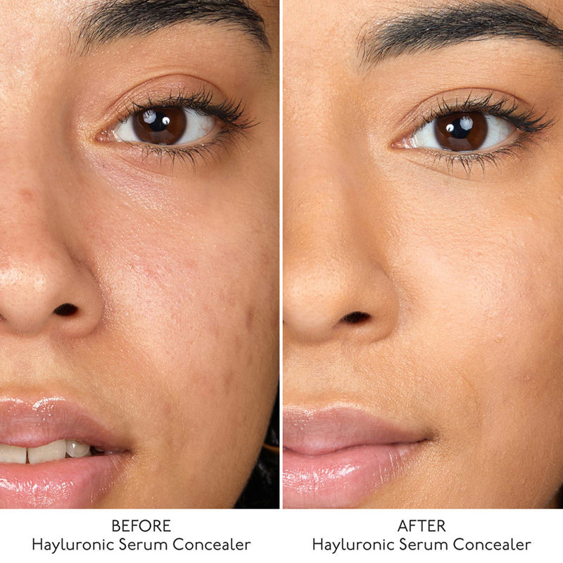 By Terry Hyaluronic Serum Concealer - 4. Rosy Nude, 5.2ml