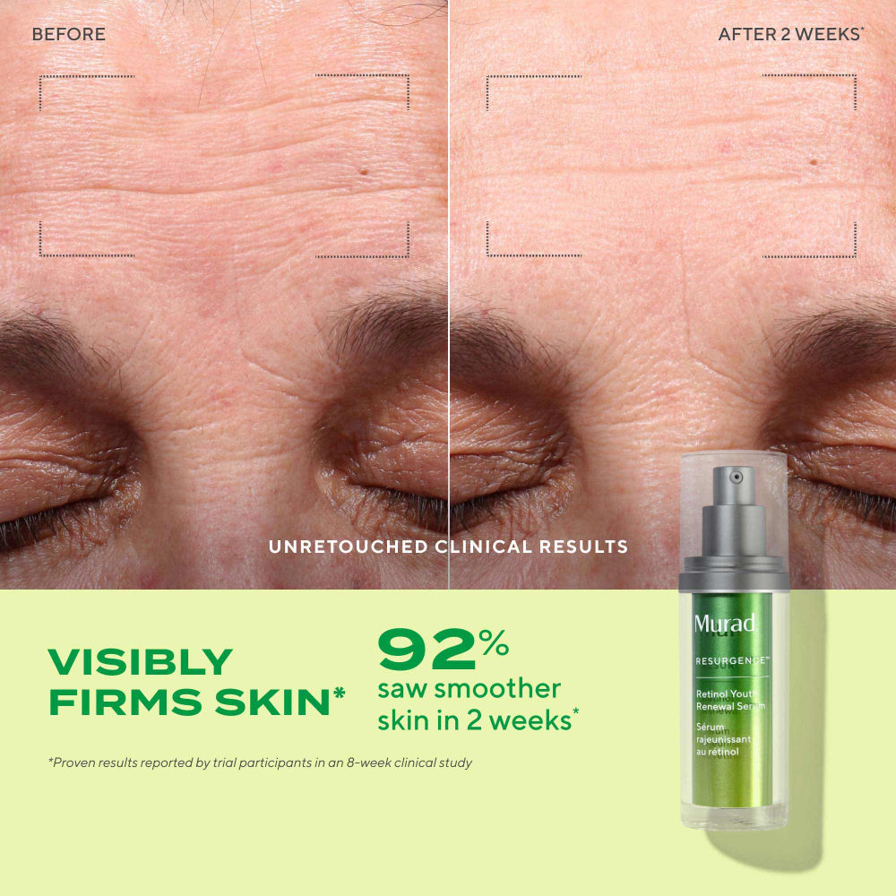 Murad Retinol Youth Renewal Serum, 30ml
